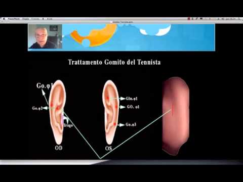 Destra dolorante sotto il bordo quando si sposta dalla parte posteriore Ginocchio prezzo chirurgia