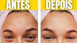 7 BENEFCIOS INCRVEIS FCEIS DO LEO DE SEMENTE DE CHIA PARA USAR TODOS OS DIAS