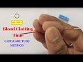 Blood Clotting Time Determination by Capillary Method | आपका खून कितने समय में ज