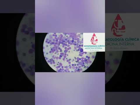 citologia de linfonódulo