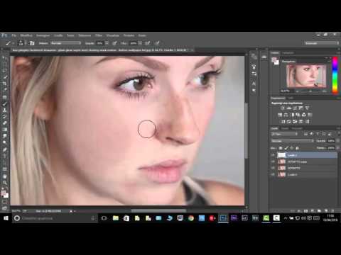 La decolorazione di creme da lentiggini e posti di pigmentary Belle ragazze rosse con lentiggini di fotografia