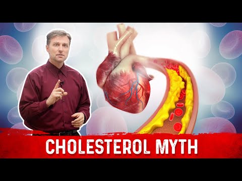 The Real Purpose of Cholesterol – Dr Berg on Cholesterol levels Part 1