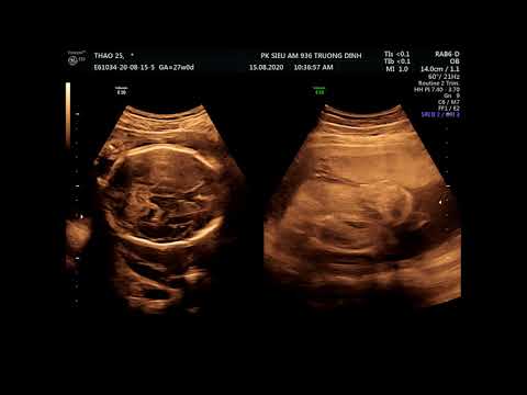 15-8\nguyễn phương thảo 25.01.1995  vd1