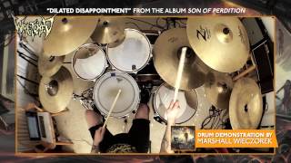 WRETCHED "Dilated Disappointment" Drum Demonstration