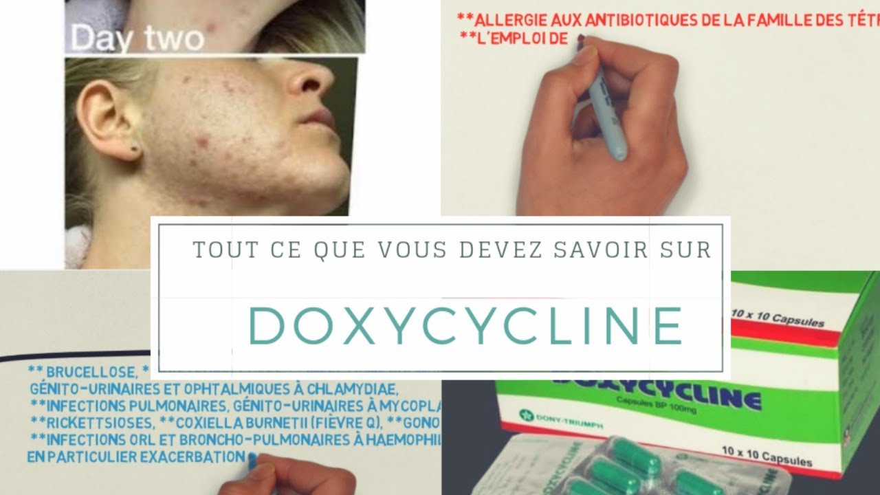Doxycyline / Tout Ce Que Vous Devez Savoir Sur Ce Médicament ( est-il efficace contre l'acné !!)