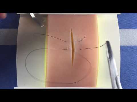 Horizontal Mattress Suture