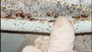 Como Eliminar Para Siempre los Chinches De Tu Cama con Remedios Caseros