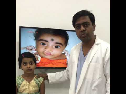 Long Term Results - Cleft Lip