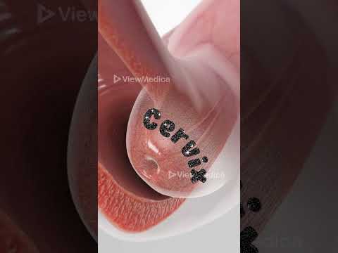 Pap Smear (3D Animation)