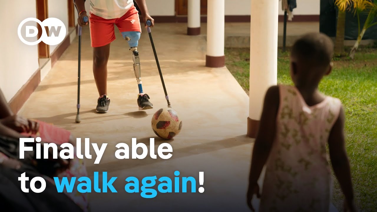 Uganda: Prostheses for a New Life