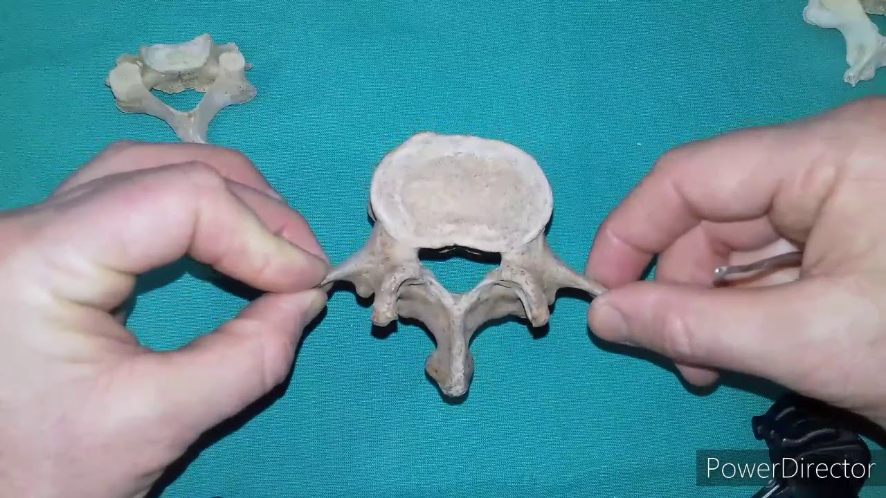 TP N° 22 Columna vertebral  Vértebra tipo  y cervicales  Articulaciones  columna. Dr. L. Esborrat