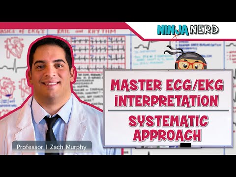 image-What does V1 V2 V3 mean in ECG?