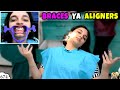 BRACES YA ALIGNERS Pihu Ke Teeth Dental Treatment Aayu And Pihu Show