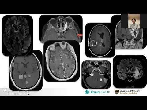 VRELS: Brain Tumor Management for the Neurologist - American Academy of Neurology