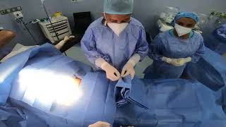 Cesarean delivery / c-section.