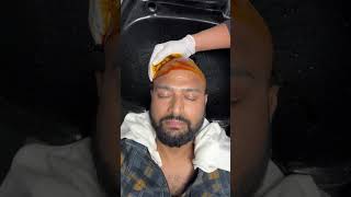 Best Hair Transplant Surgery | Latest Fue Technique #shorts #viral #ha