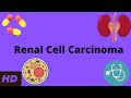 Renal Cell Carcinoma Everything You Need To Know