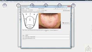 Demostración en vídeo del Software Sowen Point 1.0 de medicina oriental y Ryodoraku