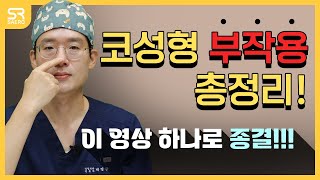 코성형 재료 및 수술 방법 부작용 관련사항