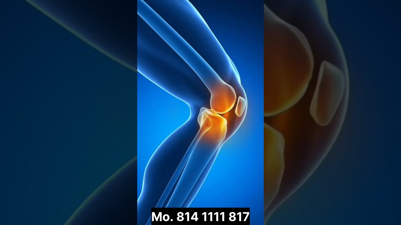 ANTI PAIN KIT Shree Gurudev Rs. 599/- Mo. 814 1111 817-9662 464615 #pain  #trending #youtubeshorts