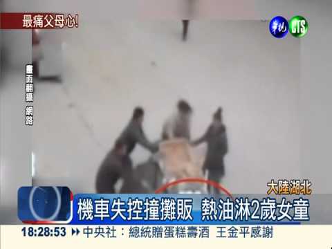 機車失控撞攤販 熱油淋2歲女童