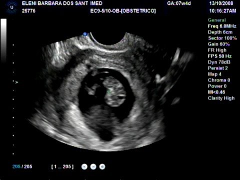 Meu Filho Momento mais Emocionante da Minha Vida.