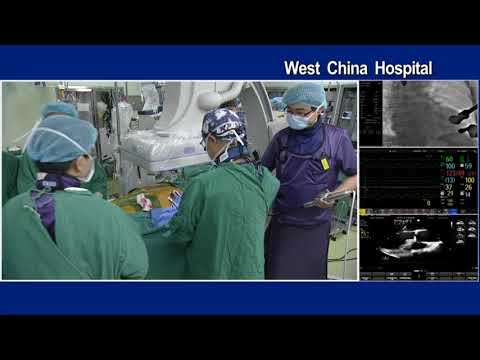 [AP VALVES 2018] Live Case & Lecture VI. TAVR for Pure AR