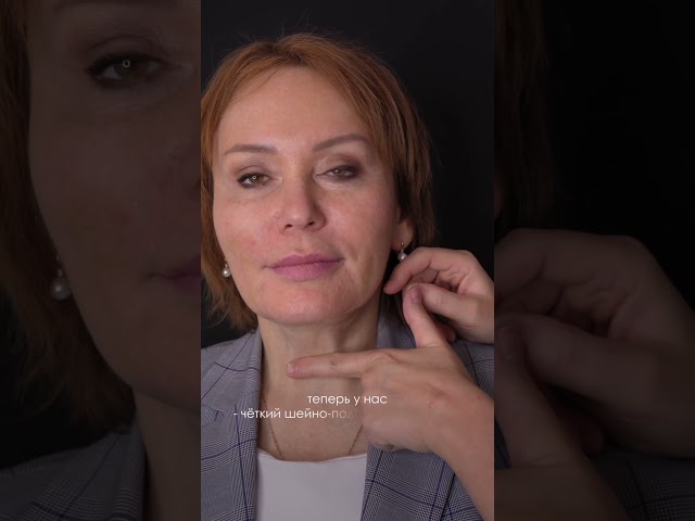 Комплексное омоложение лица и шеи