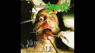 Impaled. Mondo Medicale. Full album.