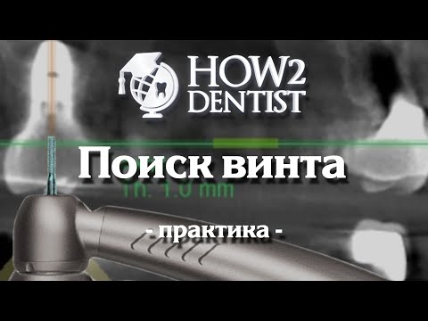 Как перевести цементную фиксацию в винтовую / How to Dentist