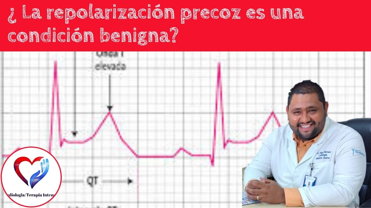 Repolarizacion precoz. ¿Es una condición benigna