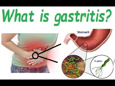 gastritis férgek