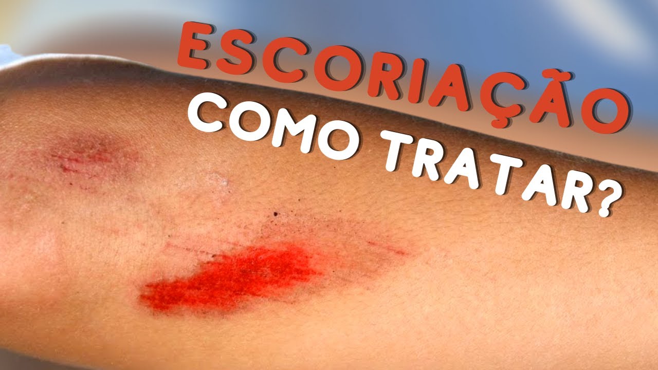 COMO TRATAR ESCORIAÇÃO