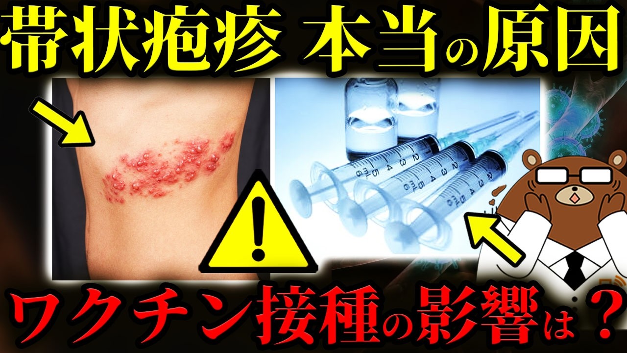 【超意外】絶対に知らないと後悔する「急増」している帯状疱疹の本当の原因。ワクチン接種の影響は？なぜ増加しているのか。なる人とならない人の違い。ストレスとの関係性は？予防法はあるのか？医師が完全解説。