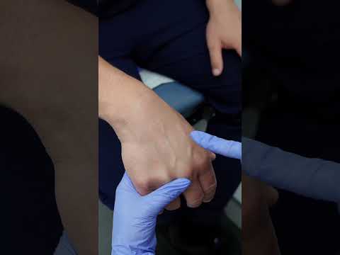 Common veins for IV insertion & blood draw: