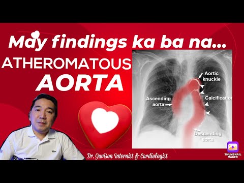 DELIKADO ba? WHAT to DO Dr. J?