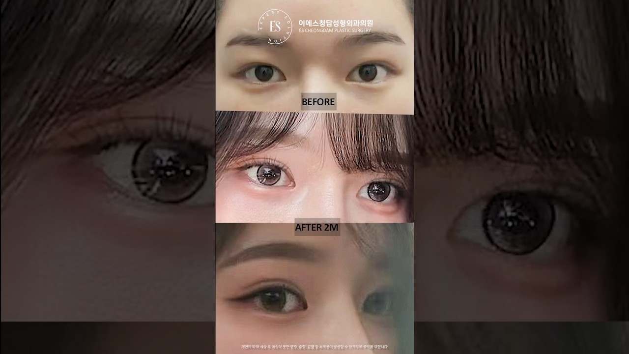 이에스 유튜브