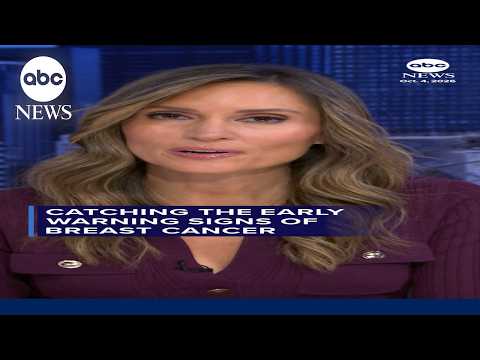 Catching the early warning signs of breast cancer