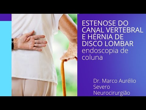 Marco Aurélio Severo Da Silva Versiani-87