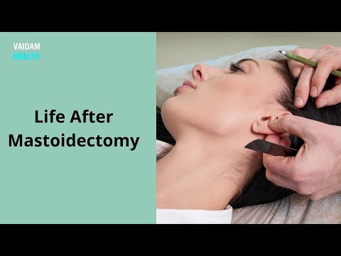 Life After Mastoidectomy