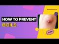 Boils Furuncles Causes Symptoms Treatments Care And Prevention