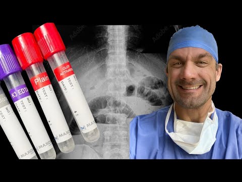 Small Bowel Obstruction - Important Labs and Tests