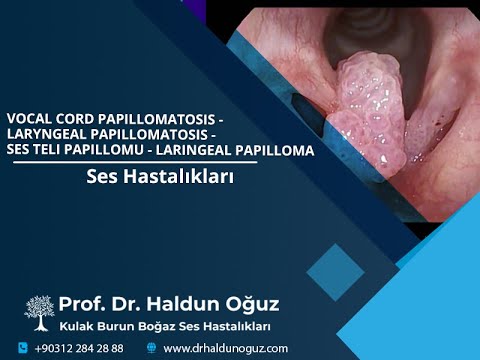 Intraductalis papilloma fórum Az emlő intraductal papilloma - tünetei