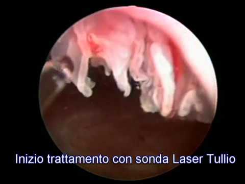 Ps plastica ginocchio costi comuni Problemi dei vasi della colonna cervicale