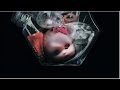 Chill Bump Not Today Official Audio