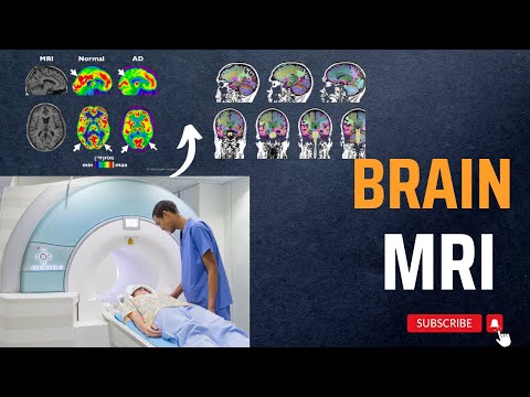 Brain MRI Positioning and Planning Brain MRI Working Principle