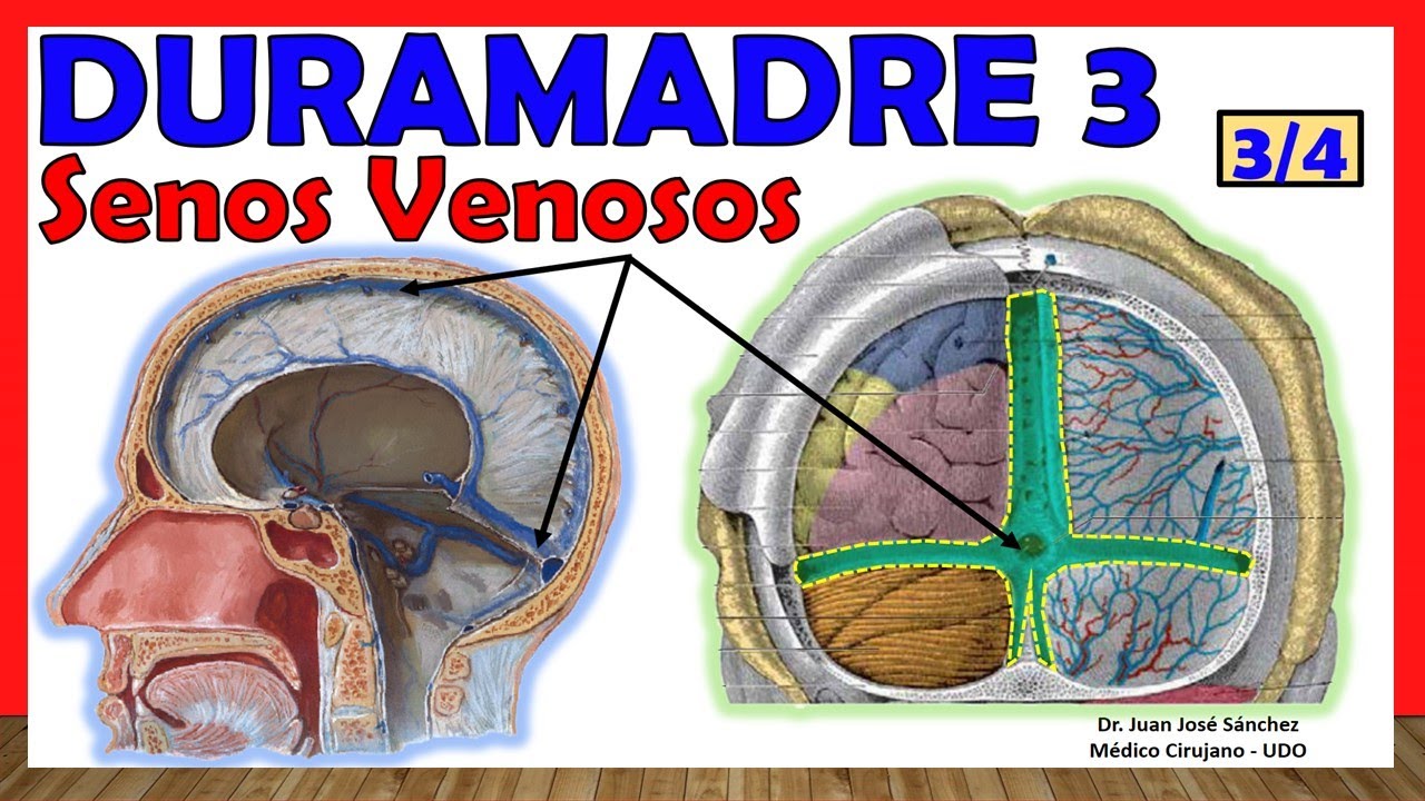 🥇DURAMADRE 3/4. (SENOS VENOSOS). ¡Explicación Fácil y Sencilla!