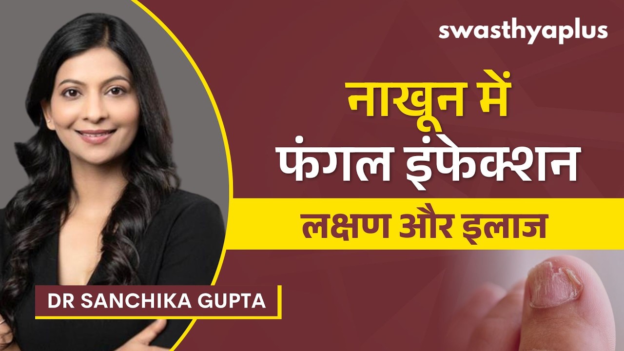 नाखून में फंगल इंफेक्शन: लक्षण और इलाज | Nail Fungus: How to Treat? in Hindi |