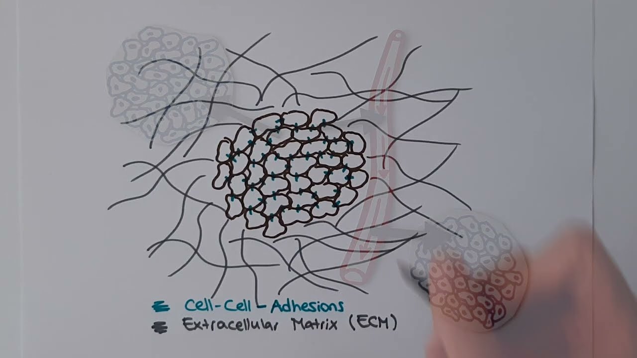 Cancer metastasis