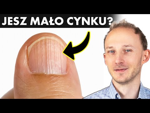 13 oznak, że powinieneś jeść więcej cynku - cynk a zdrowie i dieta | Dr Bartek Kulczyński